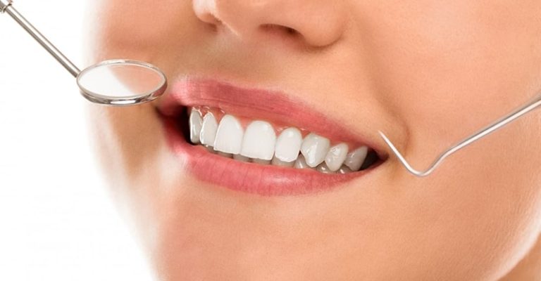 一個人在牙齒檢查過程中微笑，畫面只有半臉，牙科檢查用具靠近嘴邊。