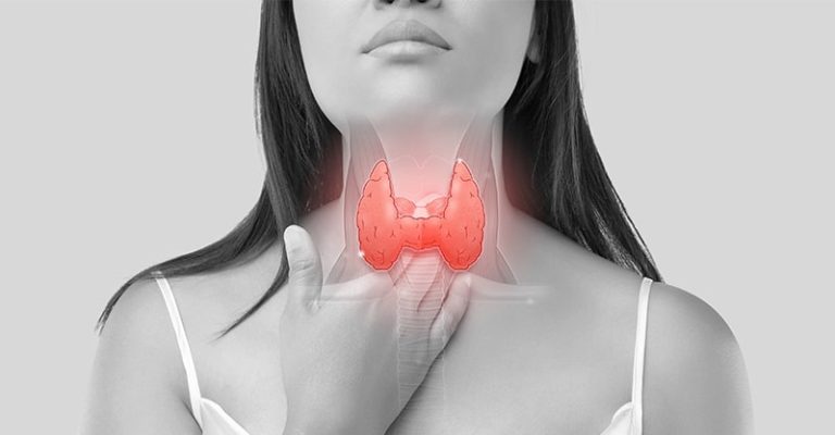 在黑白照片上，一名女子摸著喉嚨，有紅色圖案強調甲狀腺部位，象徵甲狀腺疾病或甲狀腺功能低下的症狀。