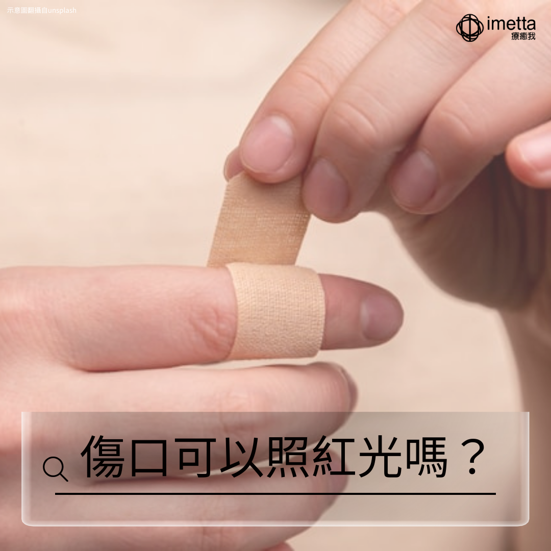 一隻手在幫另一隻手的食指包紮傷口貼ok繃。圖片底下寫著一行字:「傷口可以照紅光嗎?」